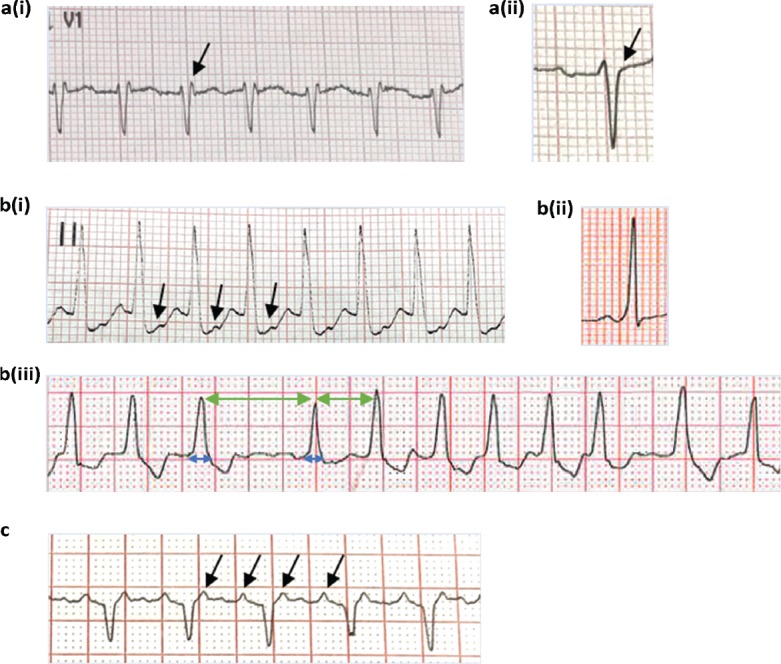 Fig 2.