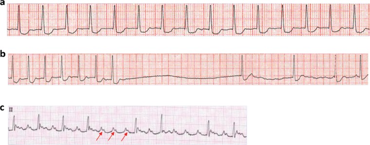 Fig 3.