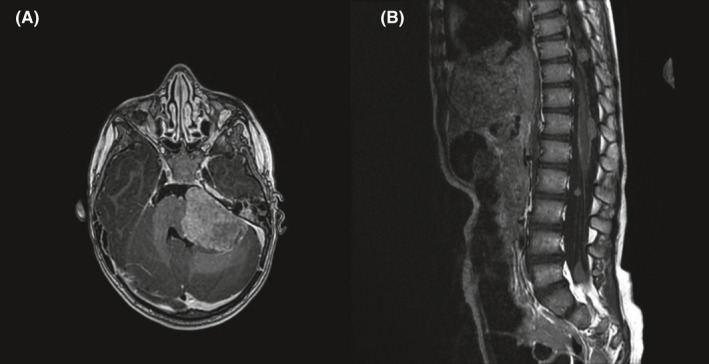 FIGURE 3