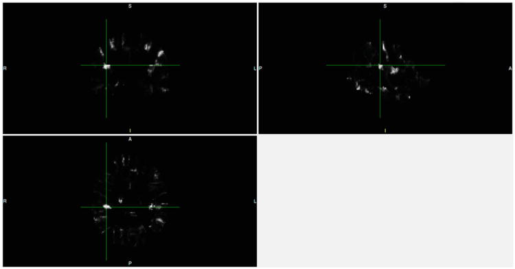 Fig. 10