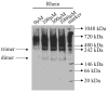 Fig. 12