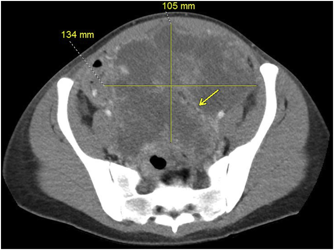 Fig. 3