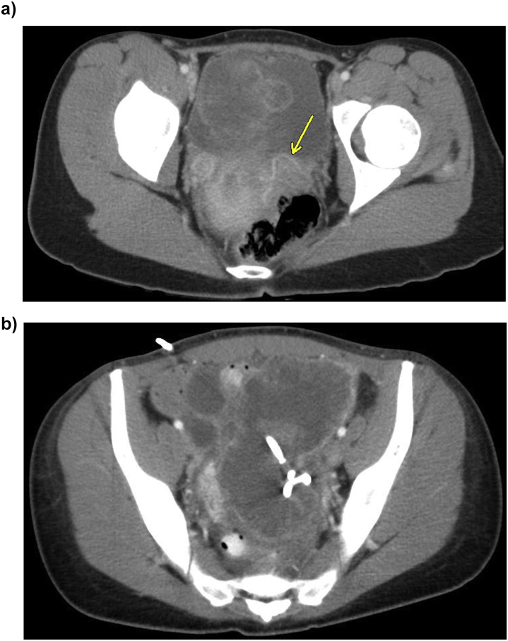 Fig.1