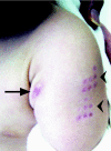 FIG. 2.