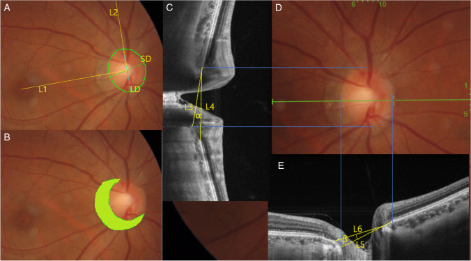 Fig. 2