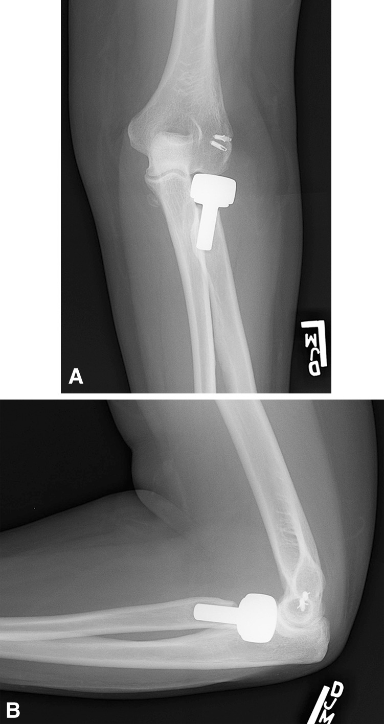 Fig. 2A–B