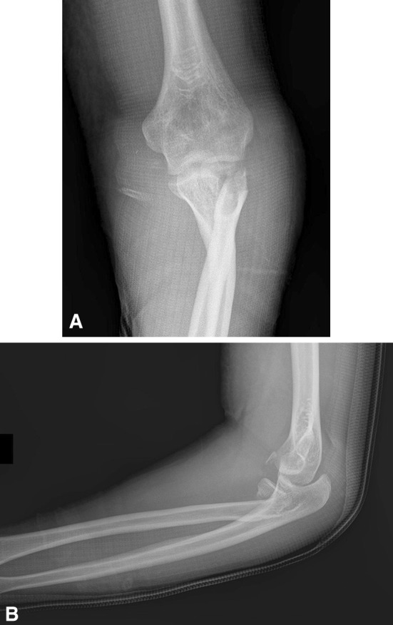 Fig. 1A–B