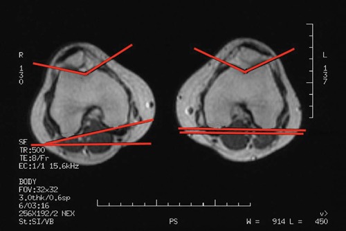 Figure 13.