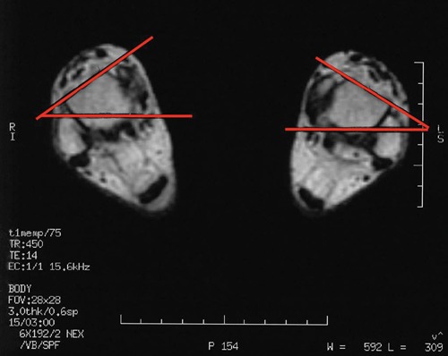 Figure 15.