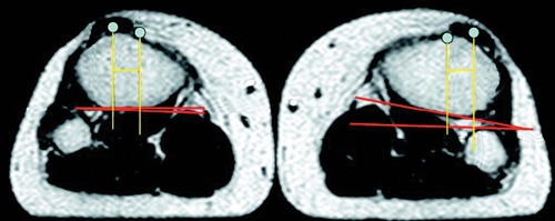 Figure 16.