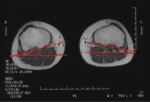 Figure 14.