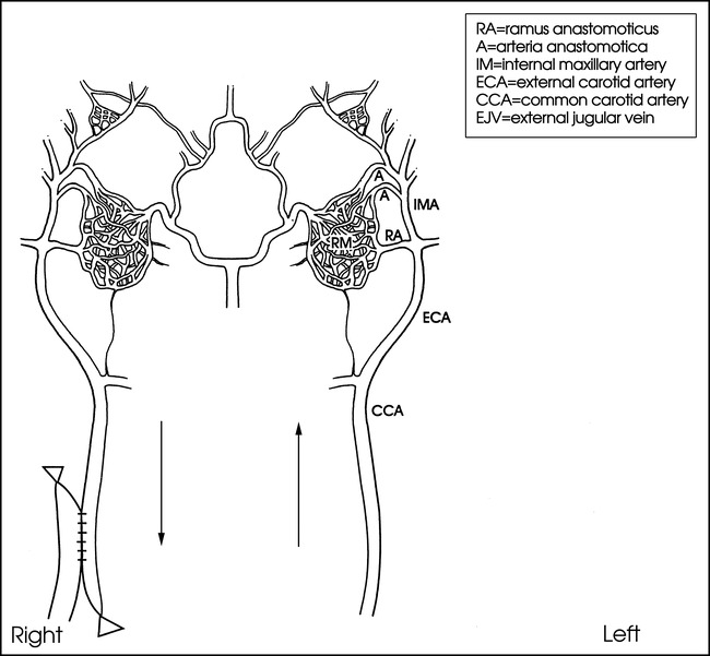 fig 1.