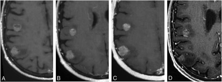 Fig 3.