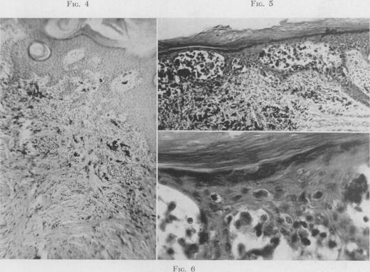 Fig. 4., Fig. 5., Fig. 6.