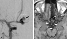 Fig 5.