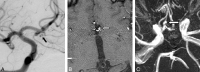 Fig 1.