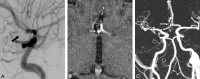 Fig 2.