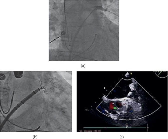 Figure 2