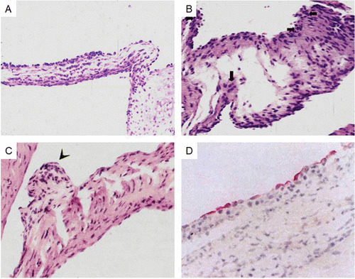 FIGURE 11