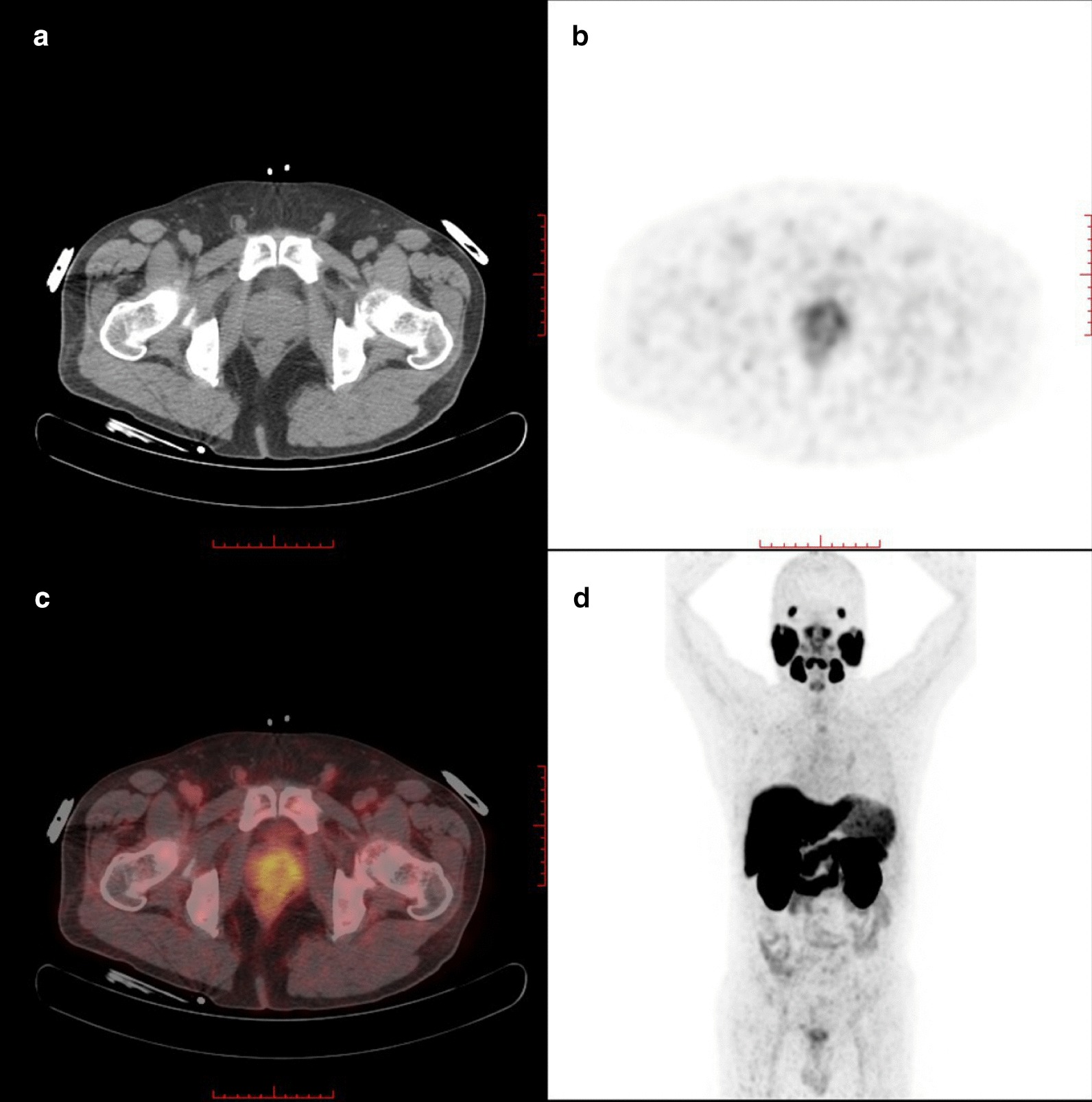 Fig. 2