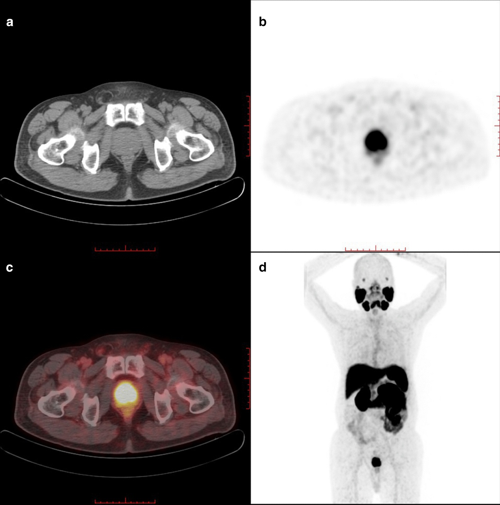 Fig. 3