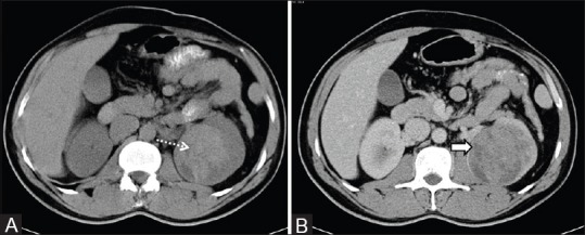 Figure 28 (A and B)