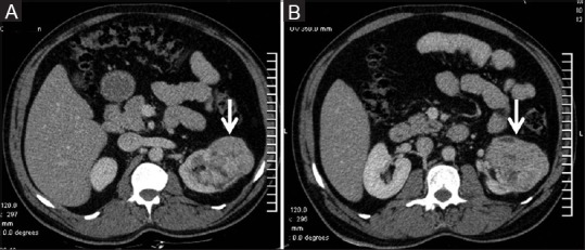 Figure 2 (A and B)