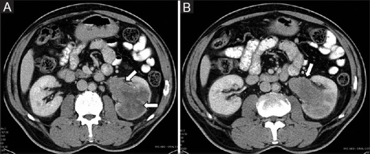 Figure 26