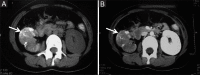Figure 4 (A and B)