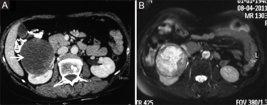 Figure 3 (A and B)