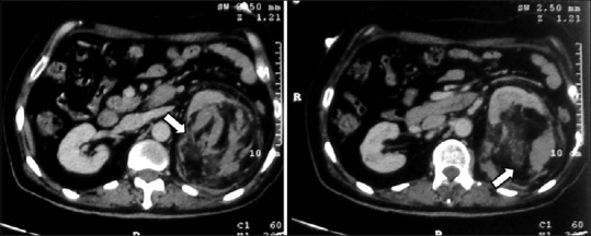 Figure 20