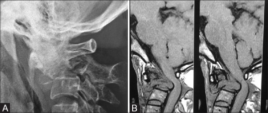 Figure 28 (A and B)