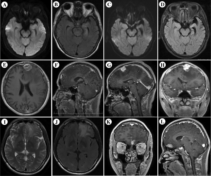 Fig. 2