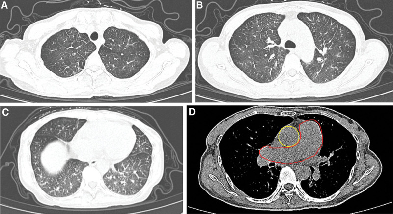 Figure 2.