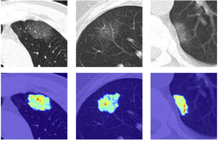 Fig. 11