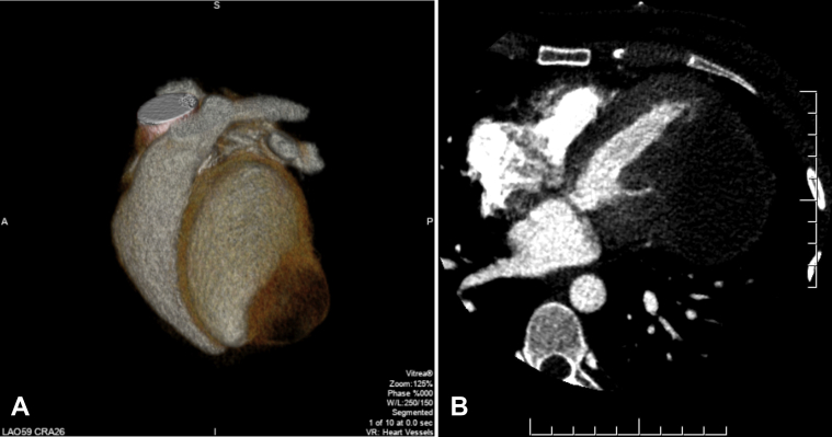 Figure 3