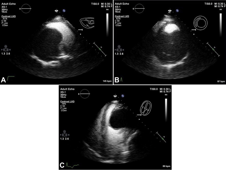 Figure 2