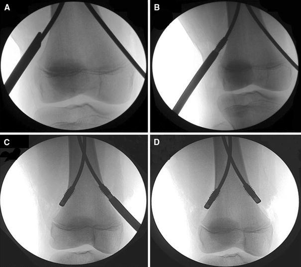 Fig. 2