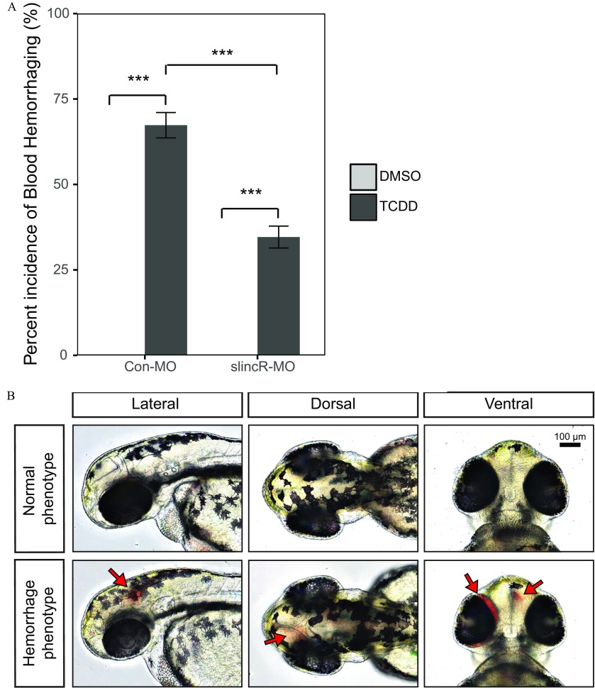 Figure 5A is a bar graph with standard error of the mean plotting percent incidence of blood hemorrhaging (percent; y-axis) in control and slincR morphants (x-axis) exposed to DMSO and TCDD. Figure 5B shows lateral, dorsal, and ventral representative images wild-type zebrafish exposed to DMSO (normal phenotype) or TCDD (hemorrhaging phenotype).