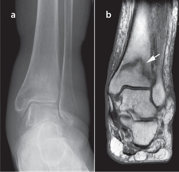 Figure 2. a, b