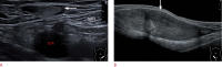 Fig. 17.