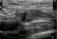 Fig. 19.