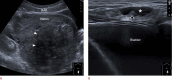 Fig. 8.