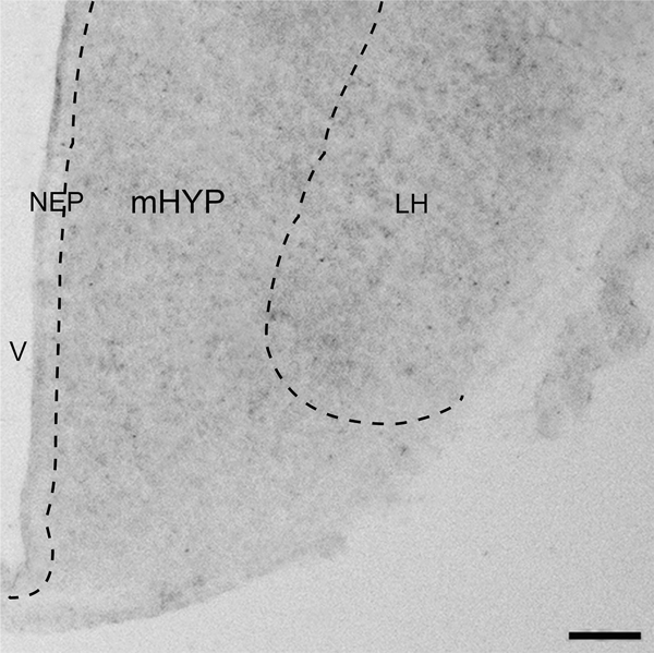 Figure 1: