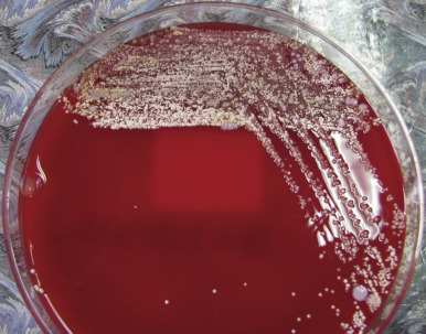 Figure 24-5