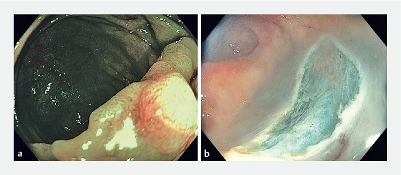 Fig. 1 a