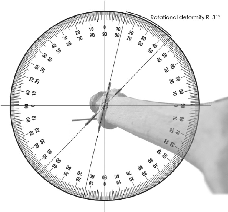 Fig. 2