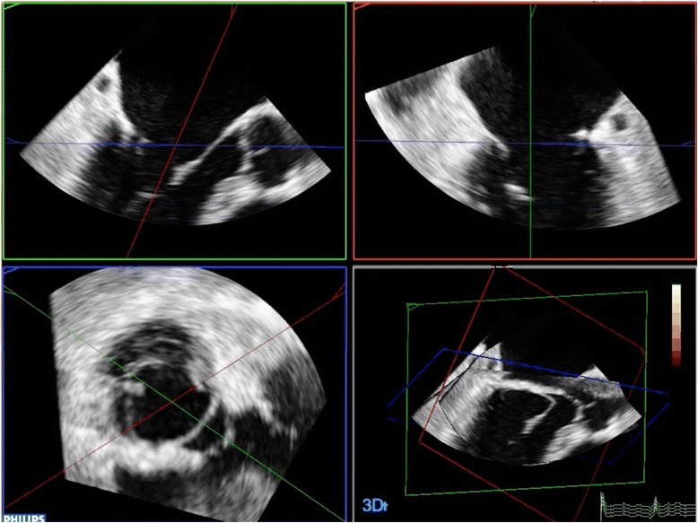 Fig. 2