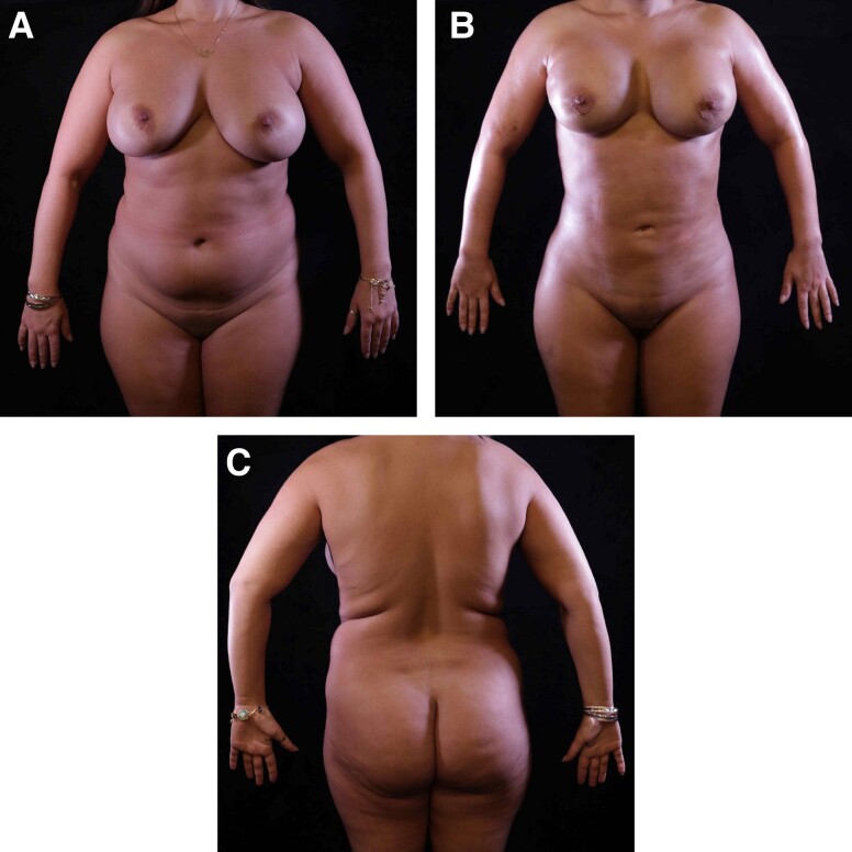 Figure 10.