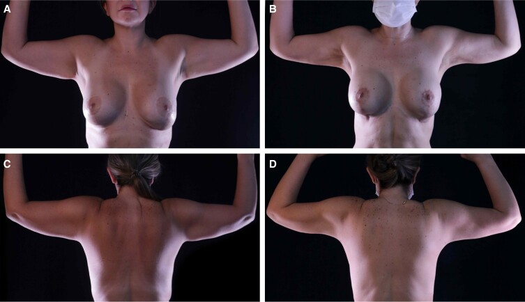 Figure 11.